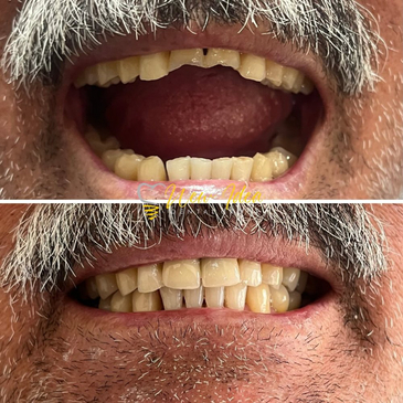 Slider image (2) New Idea Dental